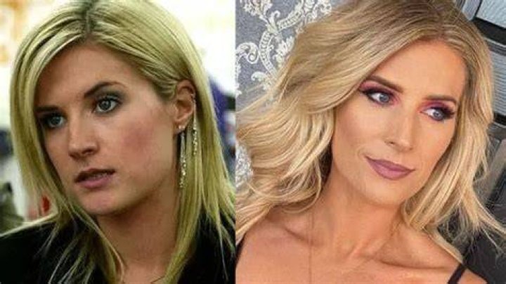 
Did Sarah Jayne Dunn Get Her Lips Done? Plastic Surgery Before And After 